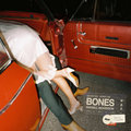 Bones